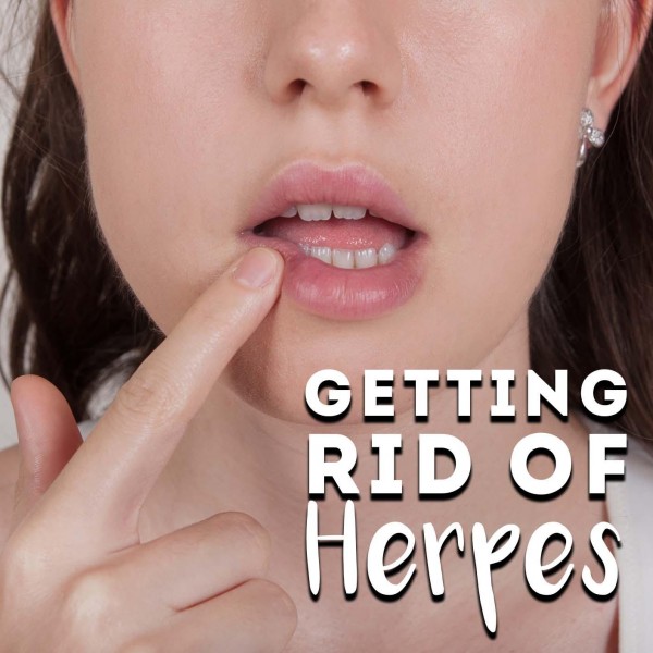 Getting Rid Of Herpes Hypnosis